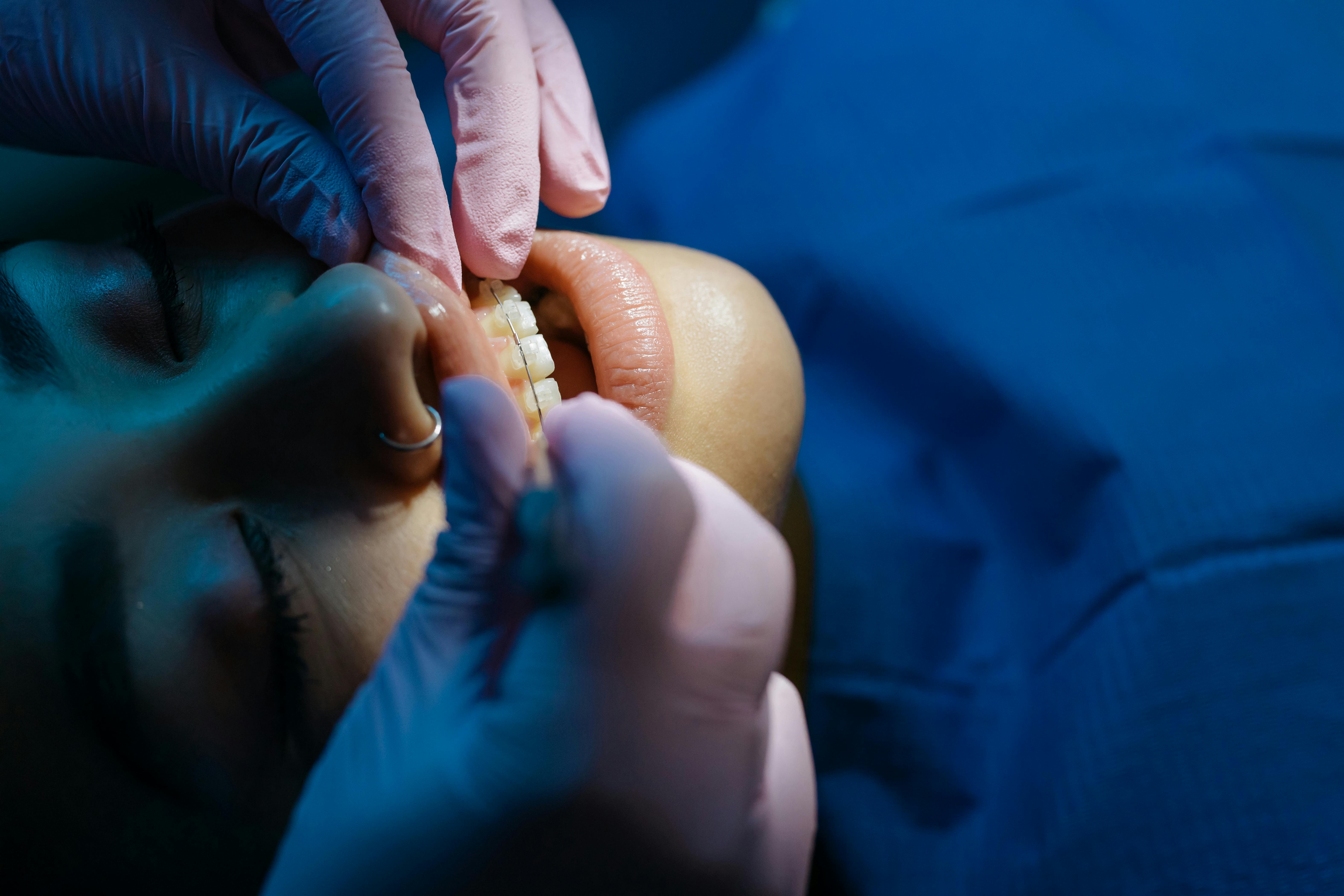 Educational dental and vision overview thumbnail